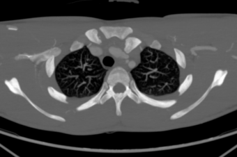 CT case 035 01