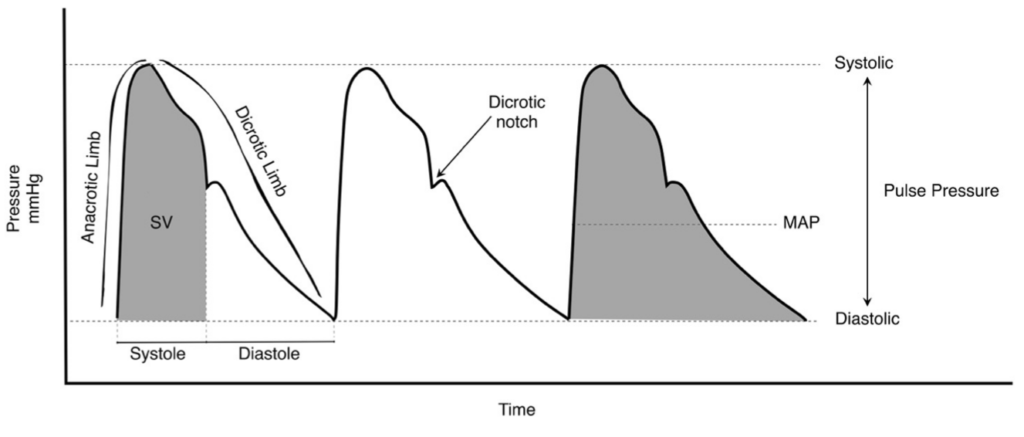 Arterial line dynamic response testing