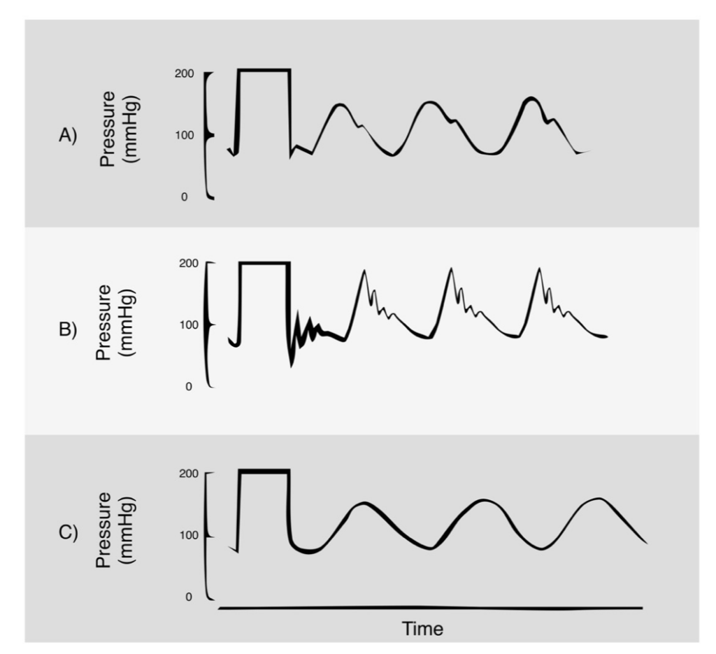 Arterial line dynamic response testing