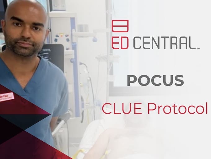 POCUS - Clue Protocol