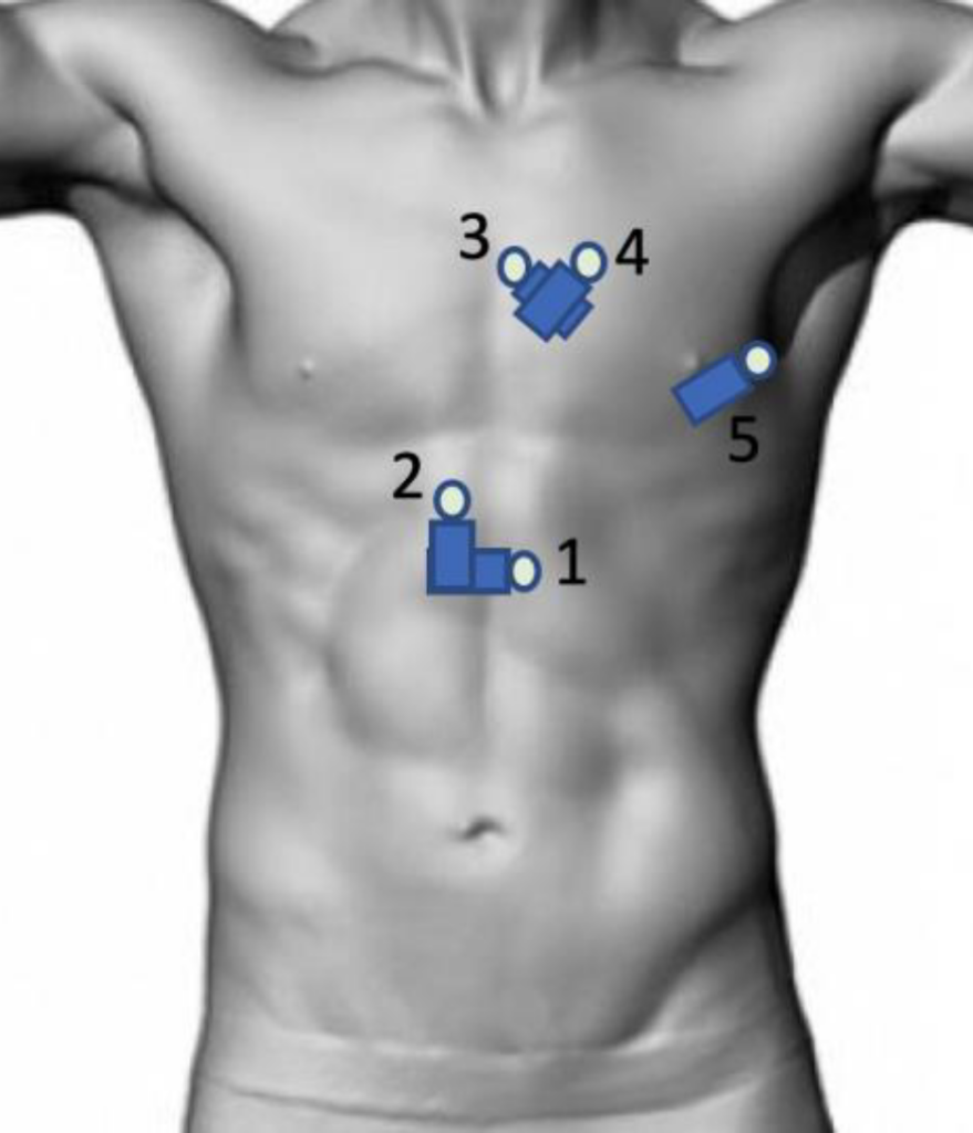 POCUS made easy Basic Echo and FELS