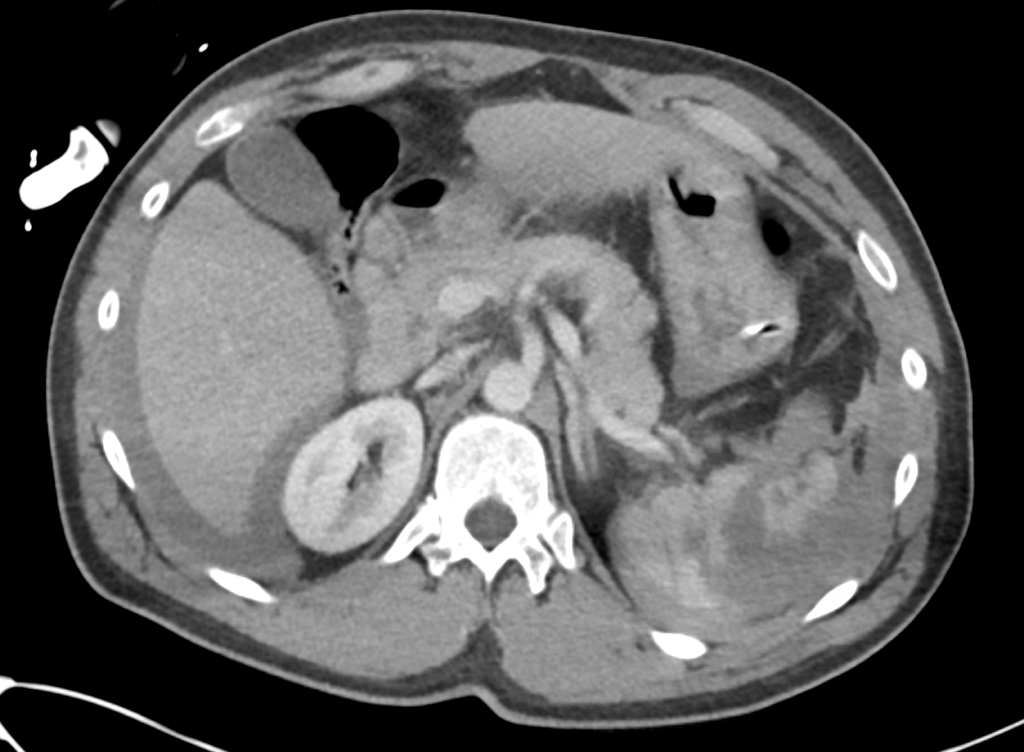 CT Case 037 01