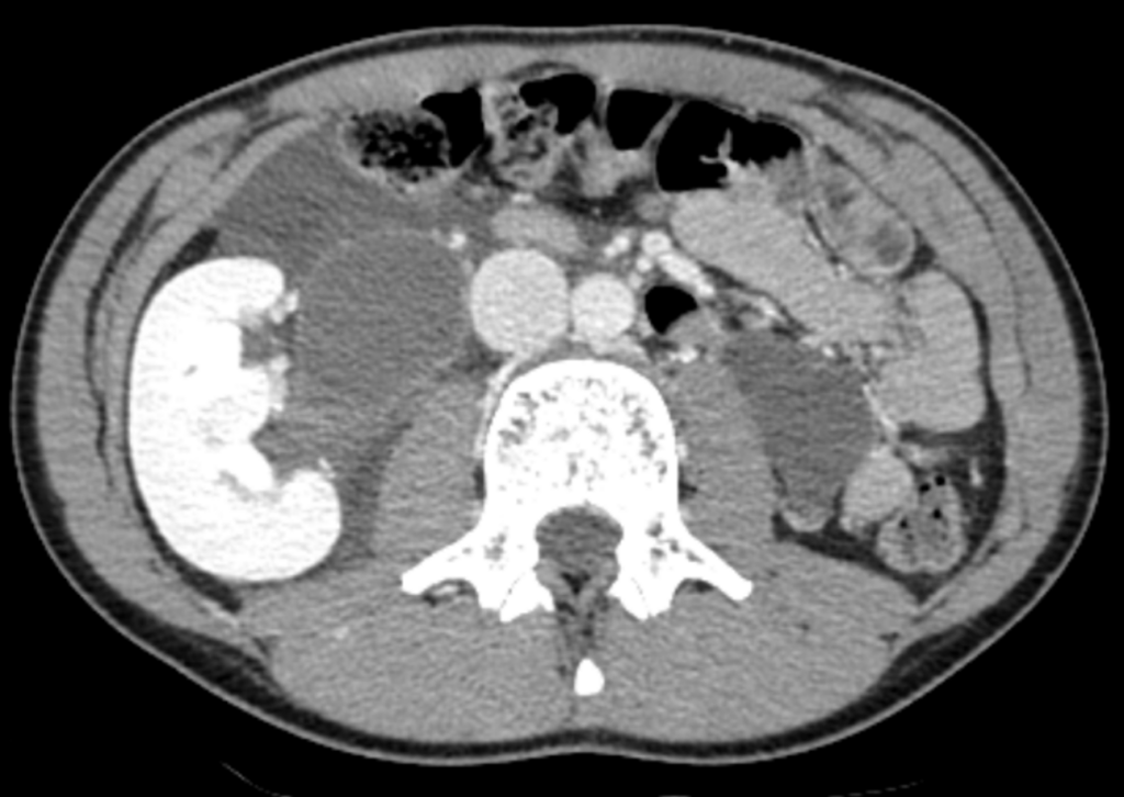 CT Case 043 01