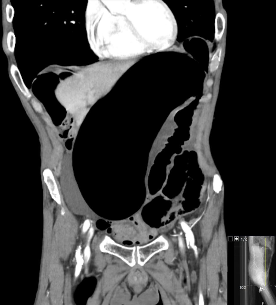 CT Case 044 02