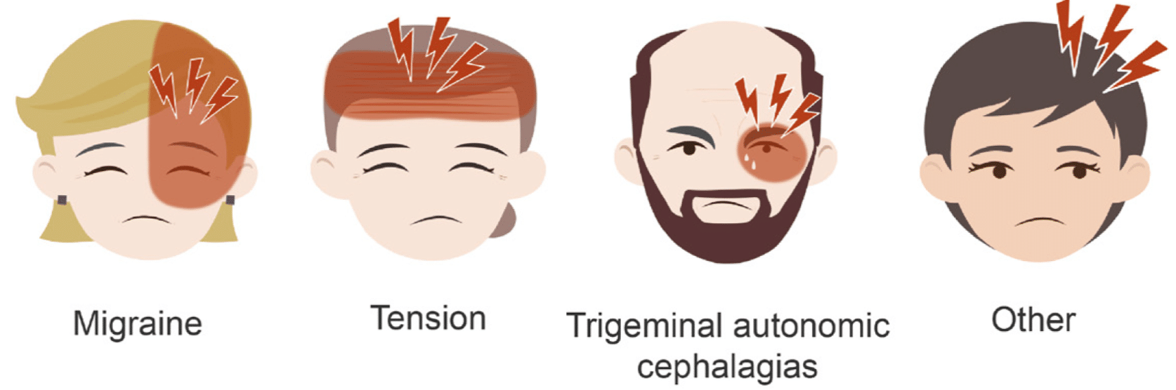 Migraines vs. Tension Headaches, St. Luke's Health