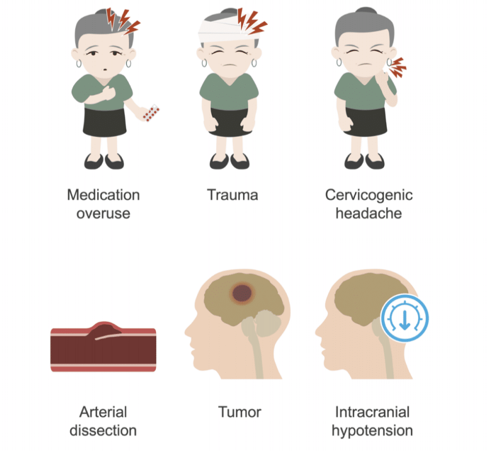 Chronic daily headaches • LITFL • Neurology library