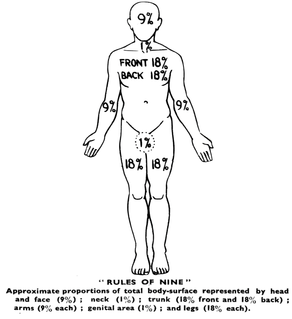 Wallace Rules of nine 1951