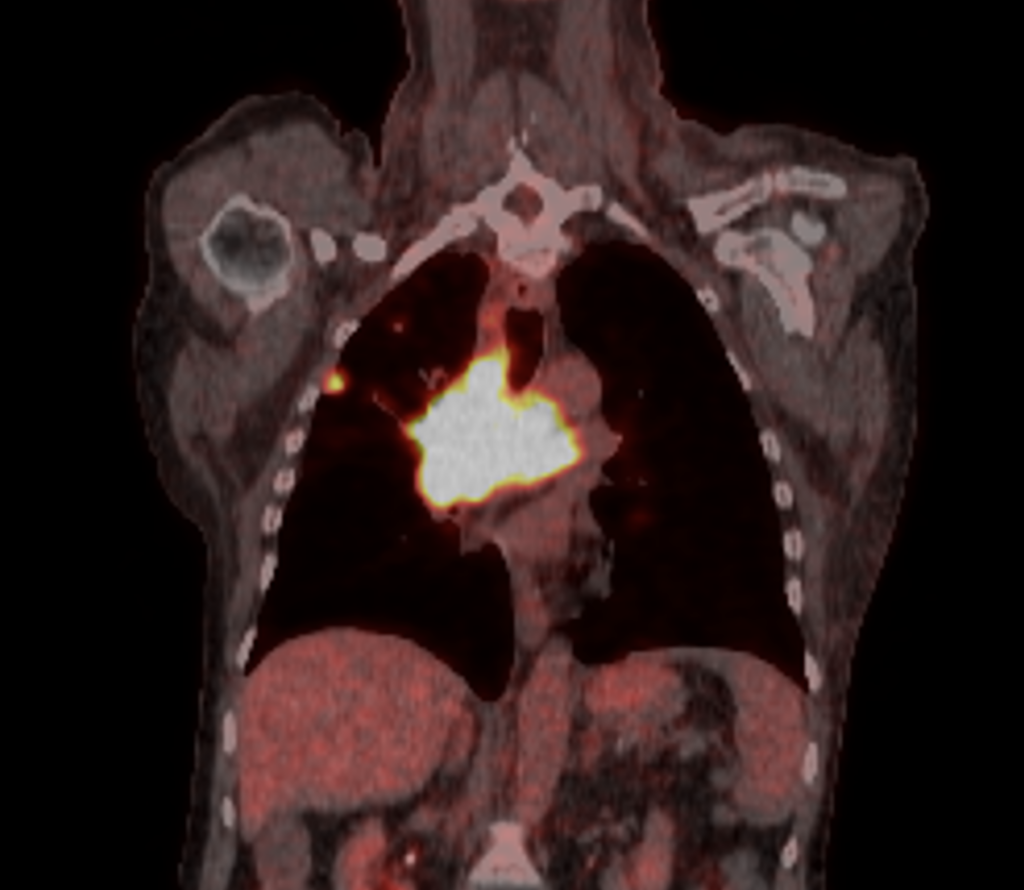 CT Case 046 007