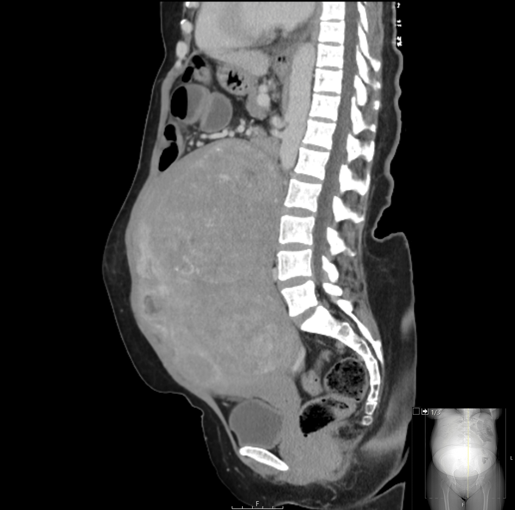 CT Case 052 • LITFL • CT scan interpretation