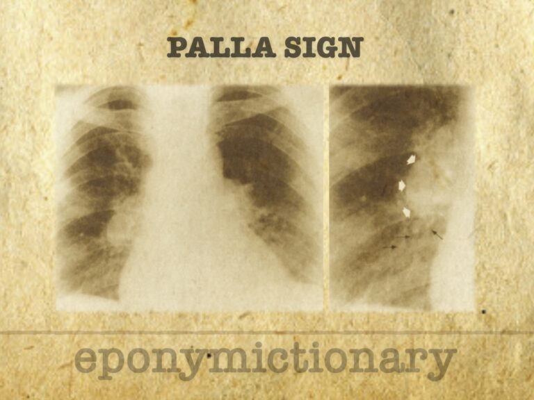 Palla sign 680