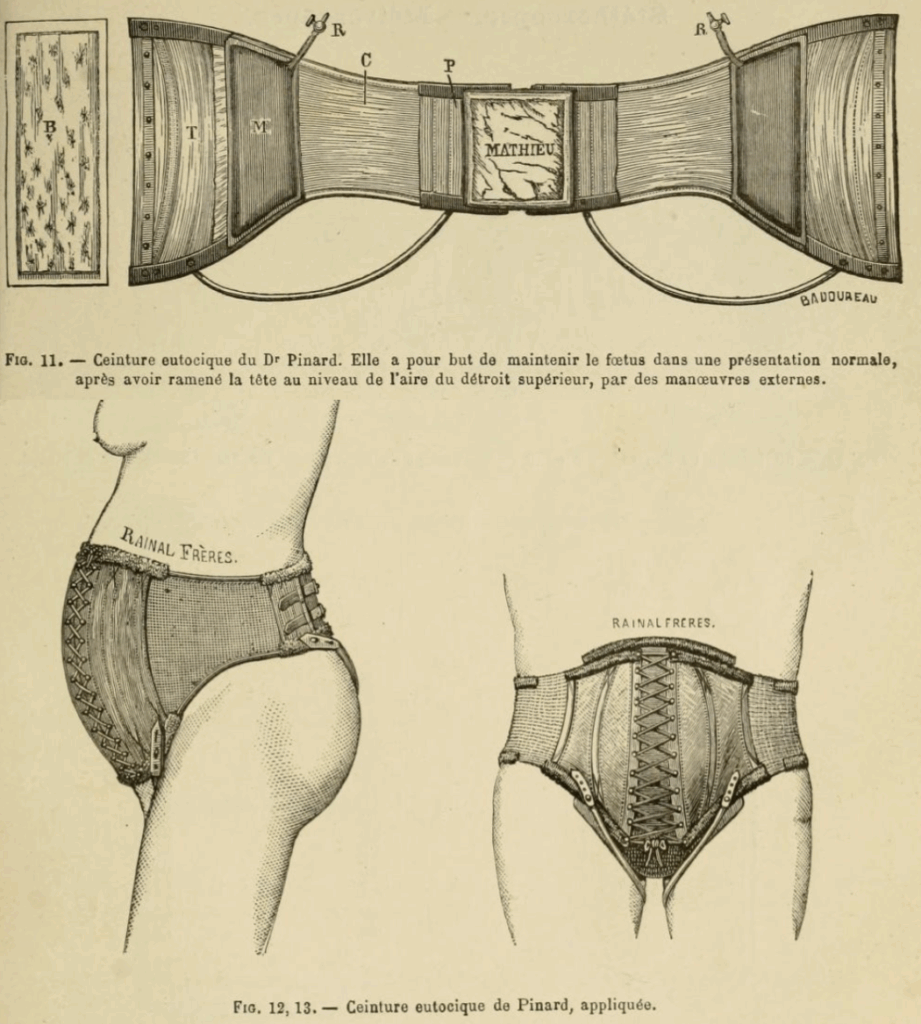 Ceinture eutocique du Dr Pinard
