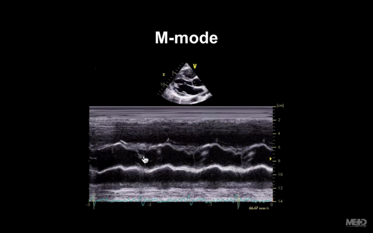 M Line Radiopedia Echo basics: Key concepts • LITFL • Radiology Library
