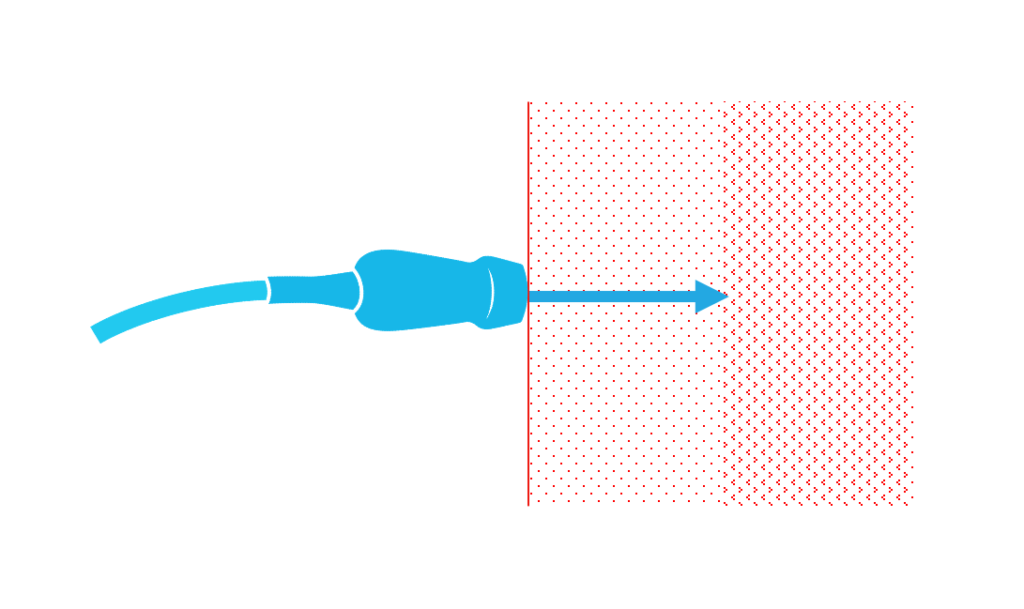 Illustration of a cardiac ultrasound probe perpendicular to the chest with an arrow pointing away from the probe into the chest