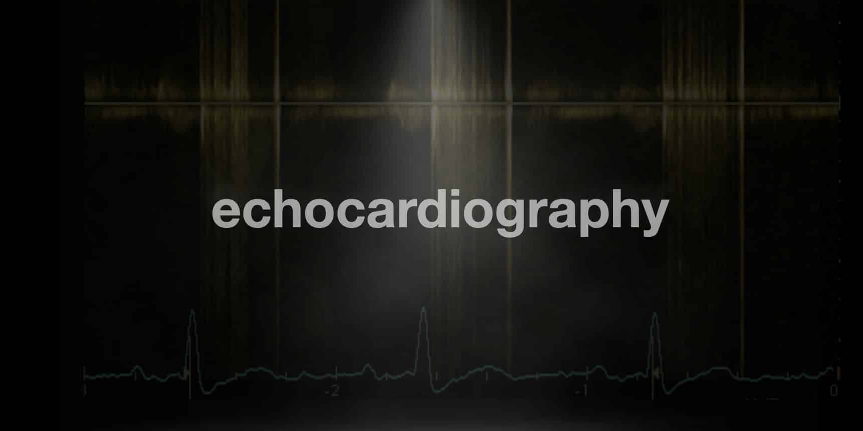 Echo Basics Mitral Stenosis LITFL Radiology Library echo-basics-mitral-stenosis-litfl-radiology-library