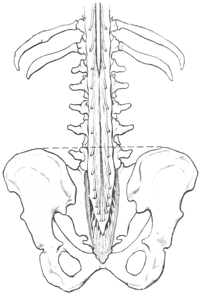 1900 Tuffier line fig 3