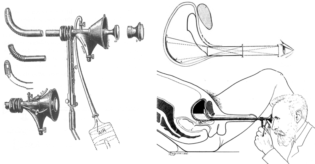 Cystoscope à air 1905