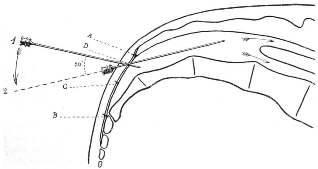 Die beiden Zeiten der Punktion