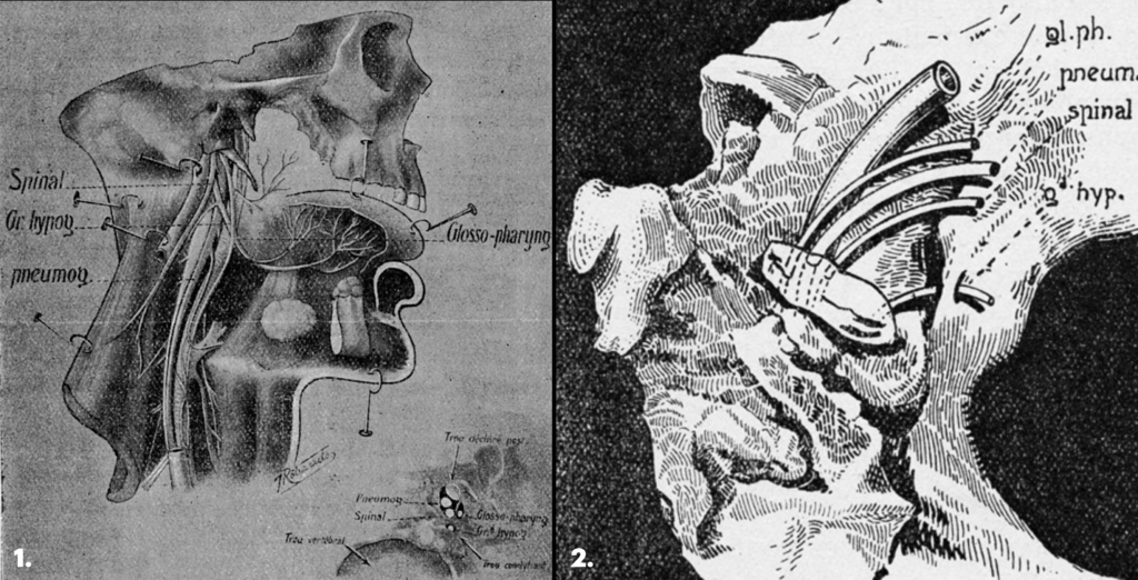 Sicard 1917 Figures 1 and 2