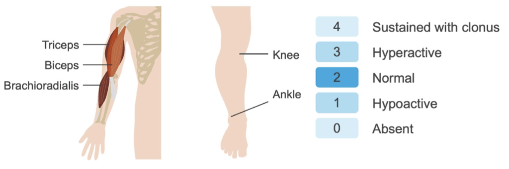 Assess reflexes