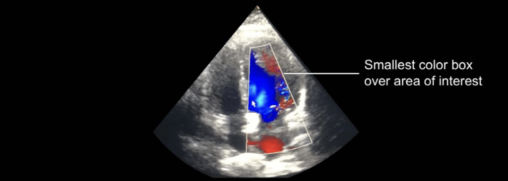Colour Doppler measurements