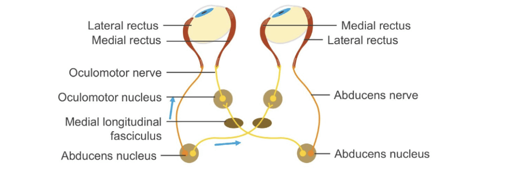 Common eye movement abnormalities