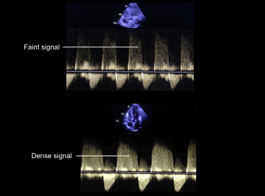 Continuous wave Doppler in AR