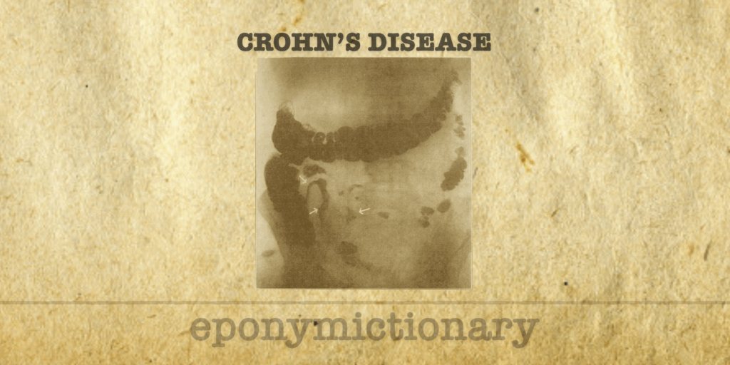 bpc 157 crohns disease Naples, FL Physician Highlights Benefits of BPC-157 Peptide Crohn's disease LITFL