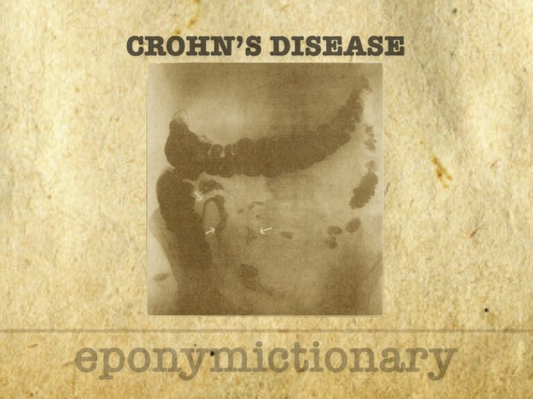 Crohn's disease 680