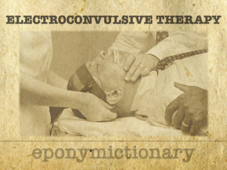 History of Electroconvulsive Therapy (ECT) 680