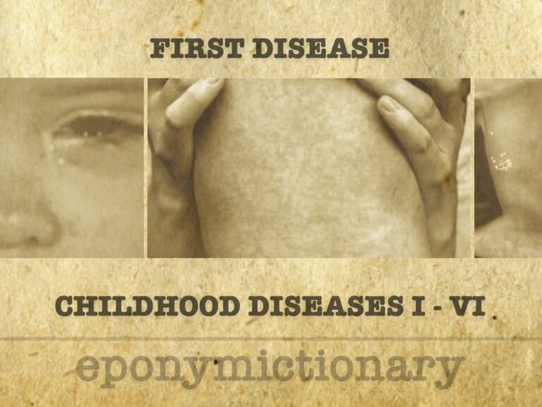 Numbered disease of childhood FIRST DISEASE 680