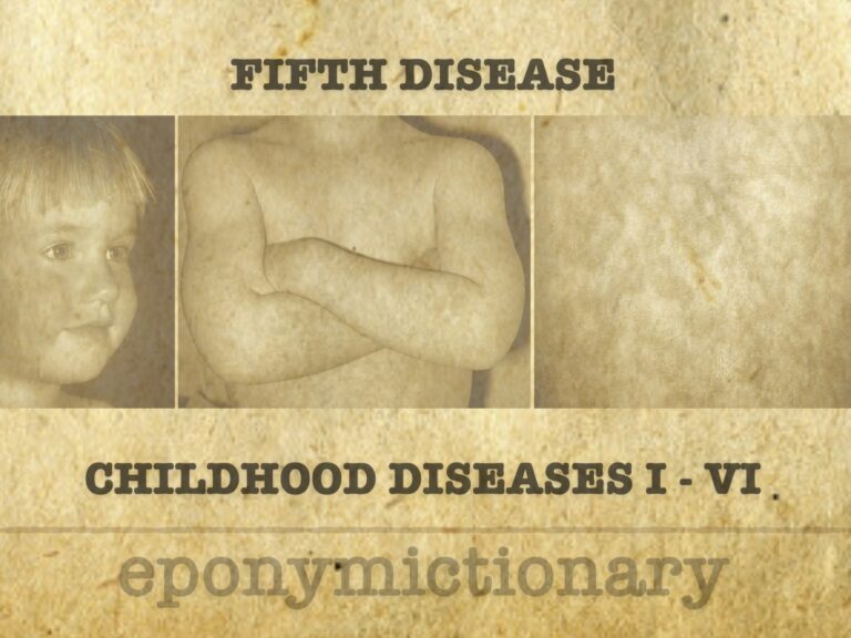 Numbered diseases of childhood FIFTH DISEASE 680