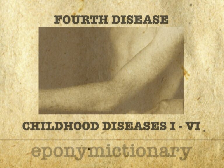 Numbered diseases of childhood FOURTH DISEASE 680