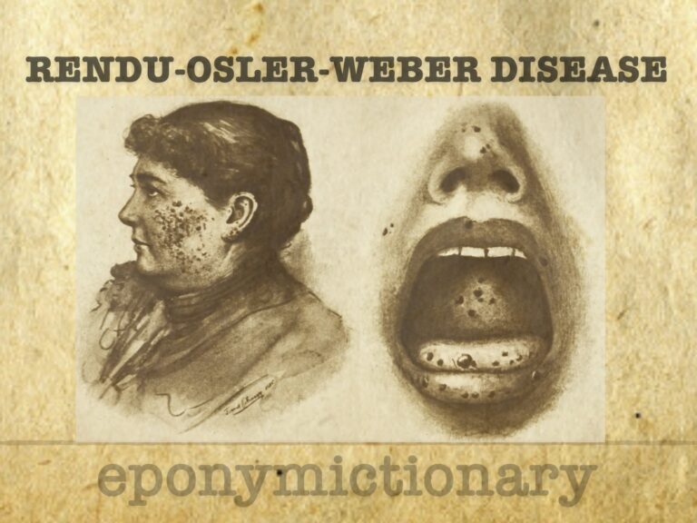 Rendu-Osler-Weber disease