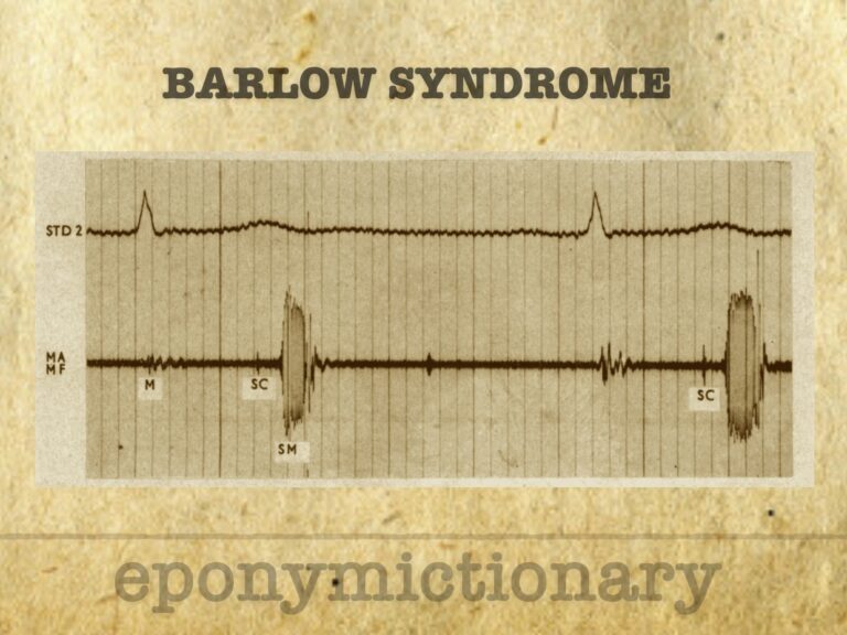 Barlow Syndrome 680