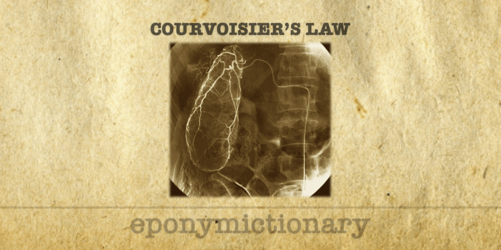 Courvoisier’s Sign • LITFL • Medical Eponym Library