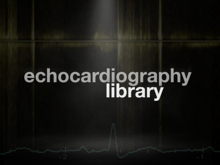 Echo library 680
