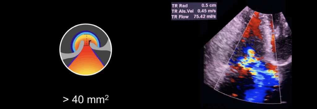 TR >40