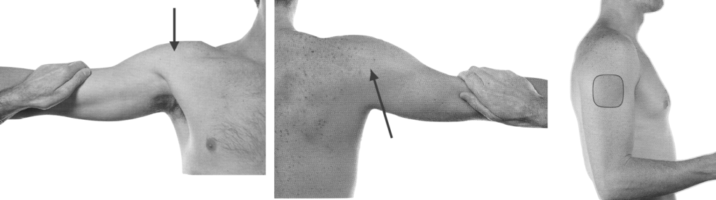 Axillary nerve anatomy