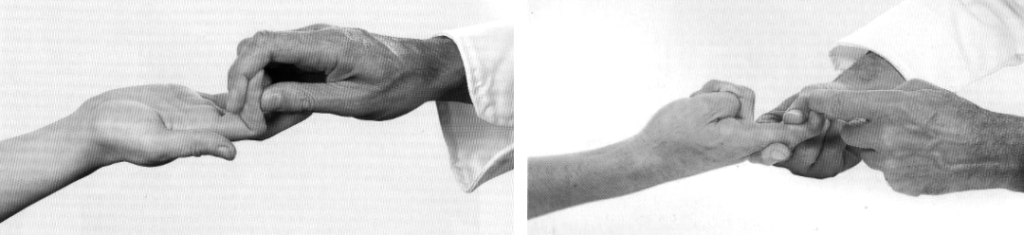 Clinical Assessment median nerve 4