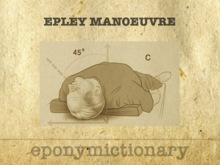 Epley manoeuvre 680