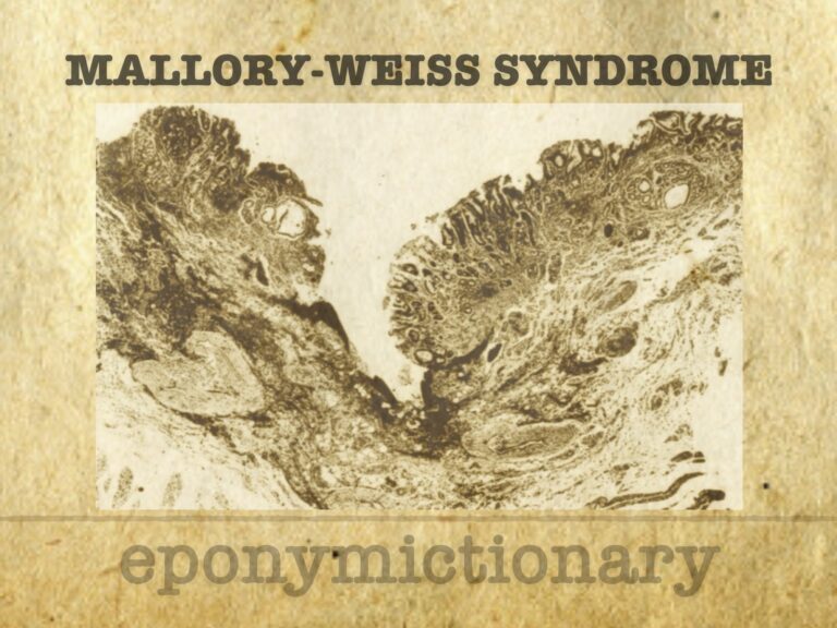 Mallory-Weiss syndrome 680