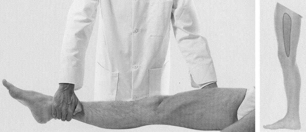 Obturator nerve examination