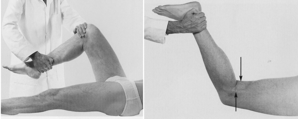 Sciatic nerve examination 1
