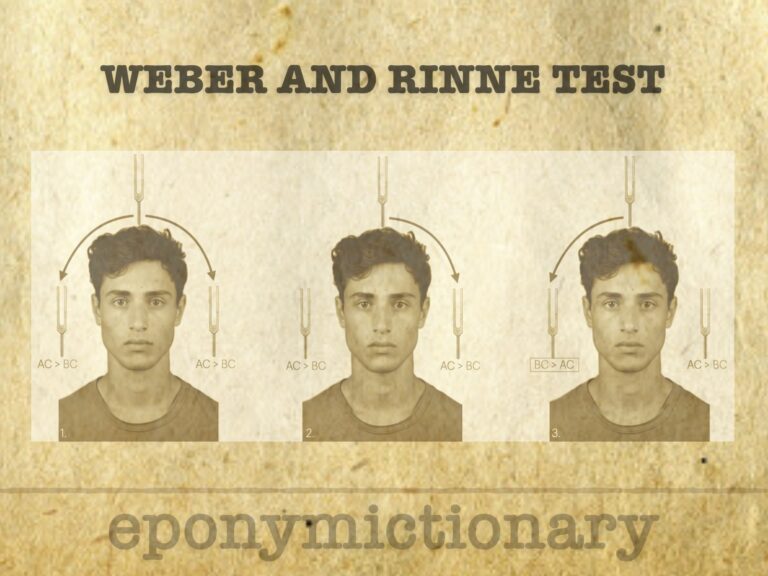 Weber and Rinne test eponymictionary