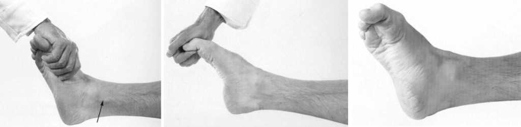 tibial nerve examination 2