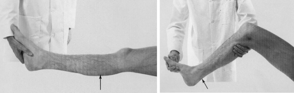 tibial nerve examination 3