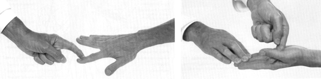 ulnar nerve clinical examination 7