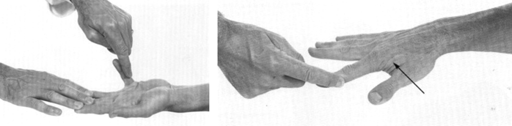 ulnar nerve clinical examination 4