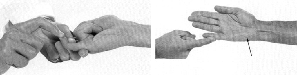 ulnar nerve clinical examination 5