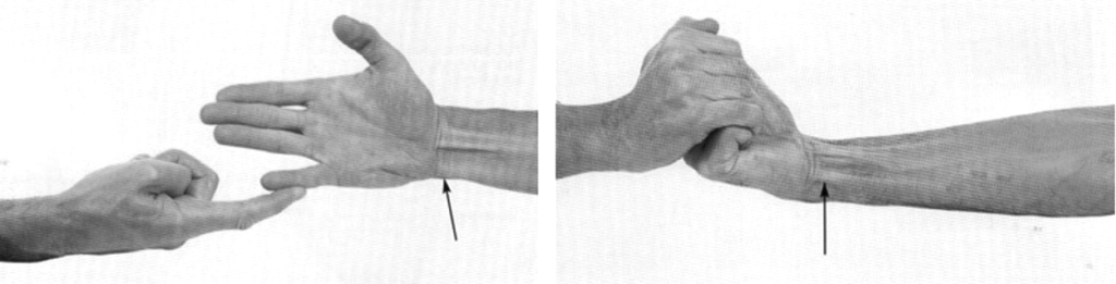 ulnar nerve clinical examination 6
